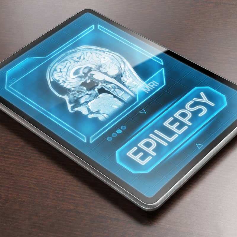 Driving with Epilepsy: Navigating the Road Ahead