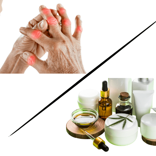 Arthritis and Cannabis